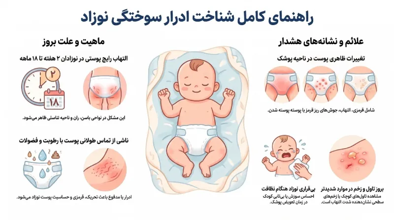 درمان ادرار سوختگی نوزادان
